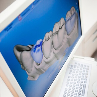 Teeth diagram displayed on computer