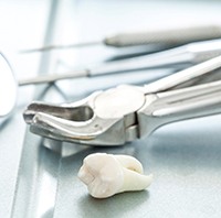 Tooth next to dental instruments after tooth extraction