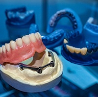 implant denture in Parker