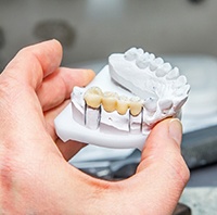 Dentist holding model of restorations for dental implants in Parker.