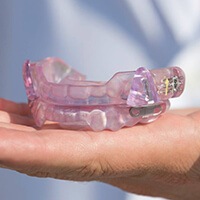 Model of an occlusal splint