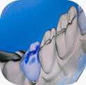 Graphical representation of teeth on chairside computer monitor