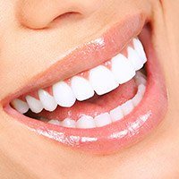 close up of beautiful smile with porcelain veneers