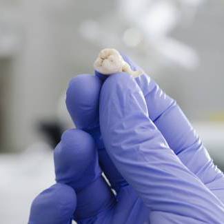 gloved hand holding an extracted tooth