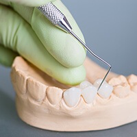 model of lower teeth with dental crown supported fixed bridge restoration