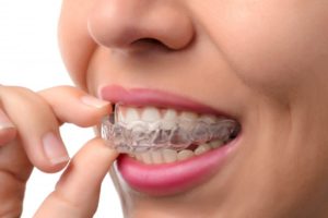 woman smiling inserting Invisalign aligners