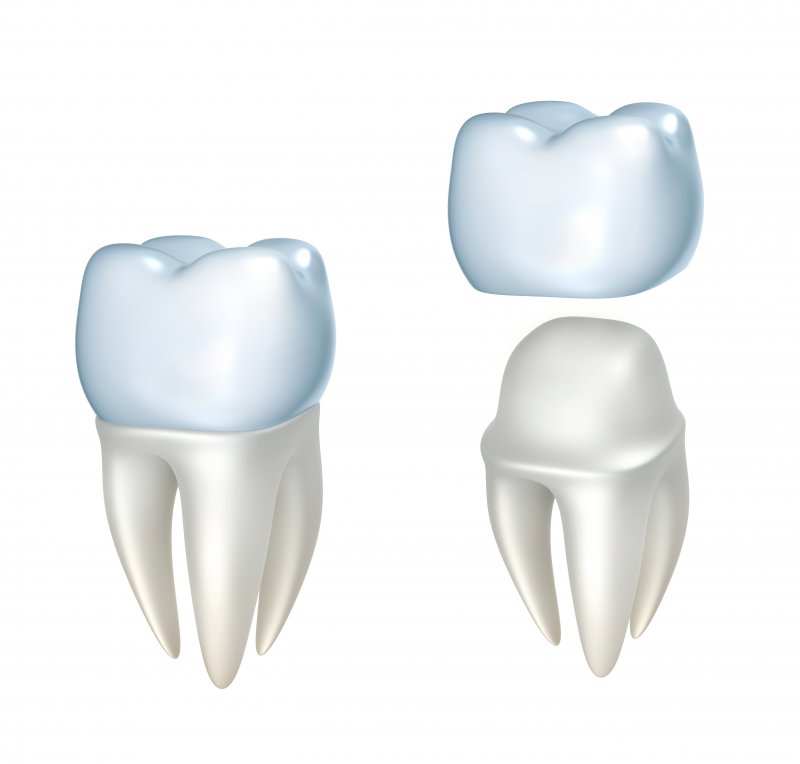 Dental crown