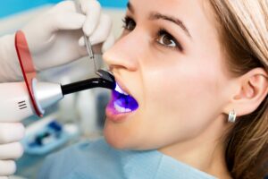 Woman with brown eyes getting dental bonding